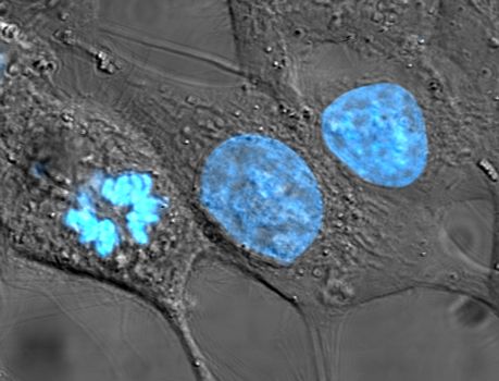 HeLa cells with fluorescent stain. CC0, by TenOfAllTrades on Wikipedia.